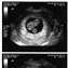 Baby Rivner 9 weeks